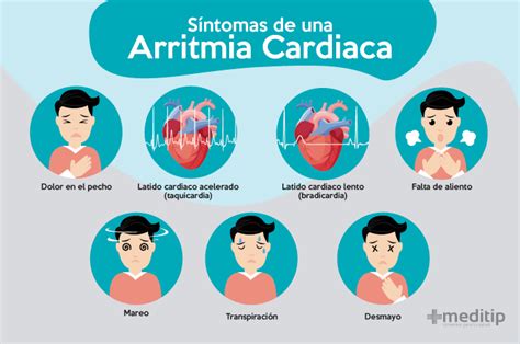 arritmia cardiaca sintomas signos